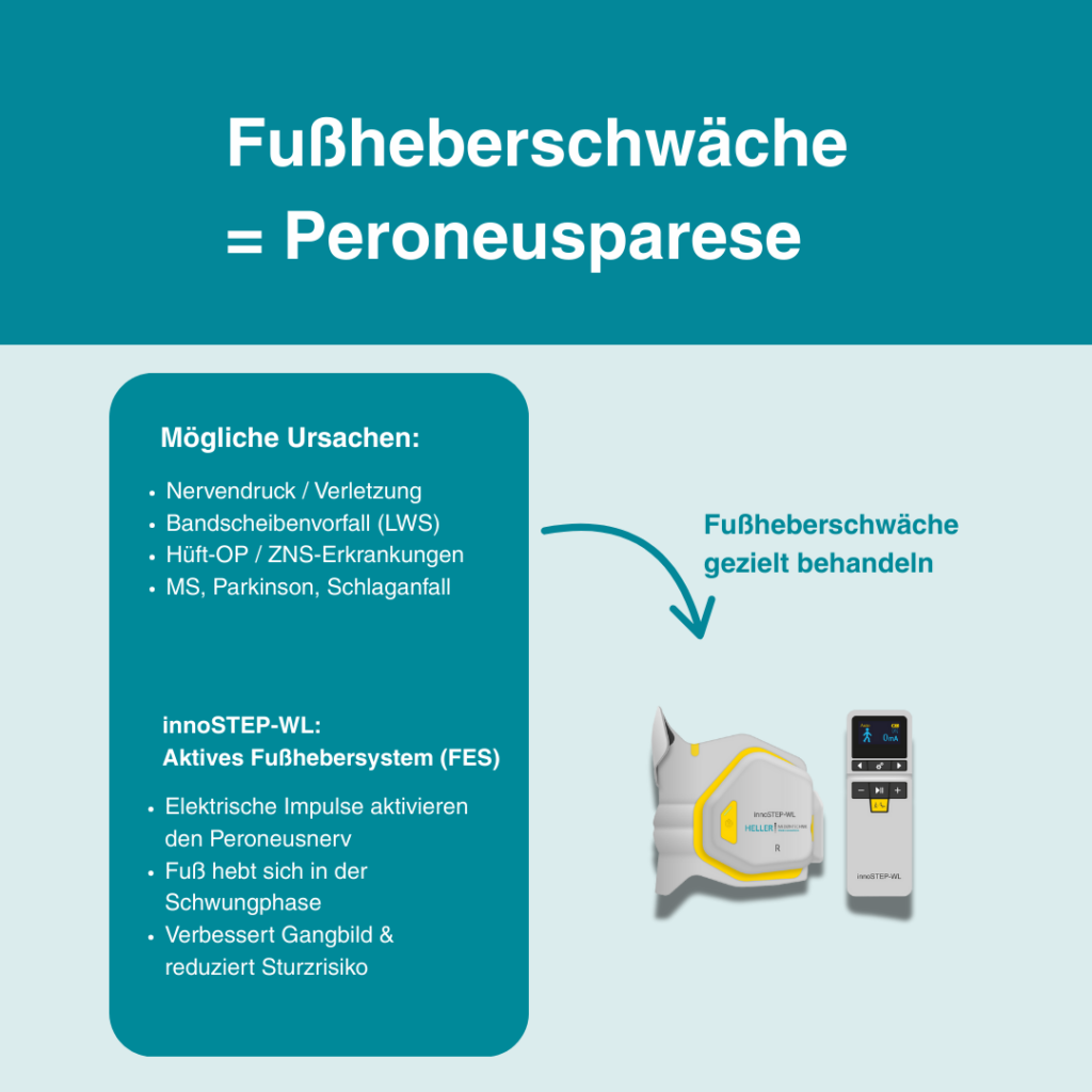 Die Ursachen einer Fußheberschwäche (Peroneusparese) werden auf einem Paper dargestellt.